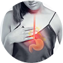 Acid Reflux