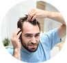 Hair Loss